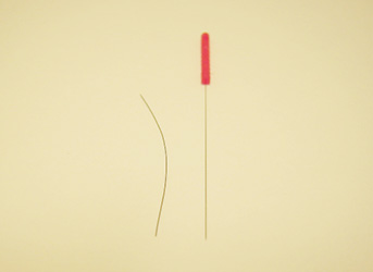 acupuncture_03